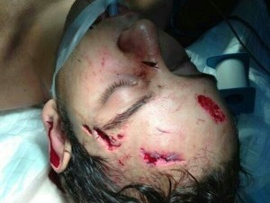Joven Golpeado