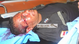 Coronel Muerto