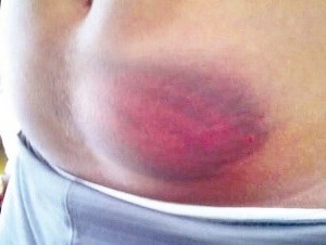Tortura1