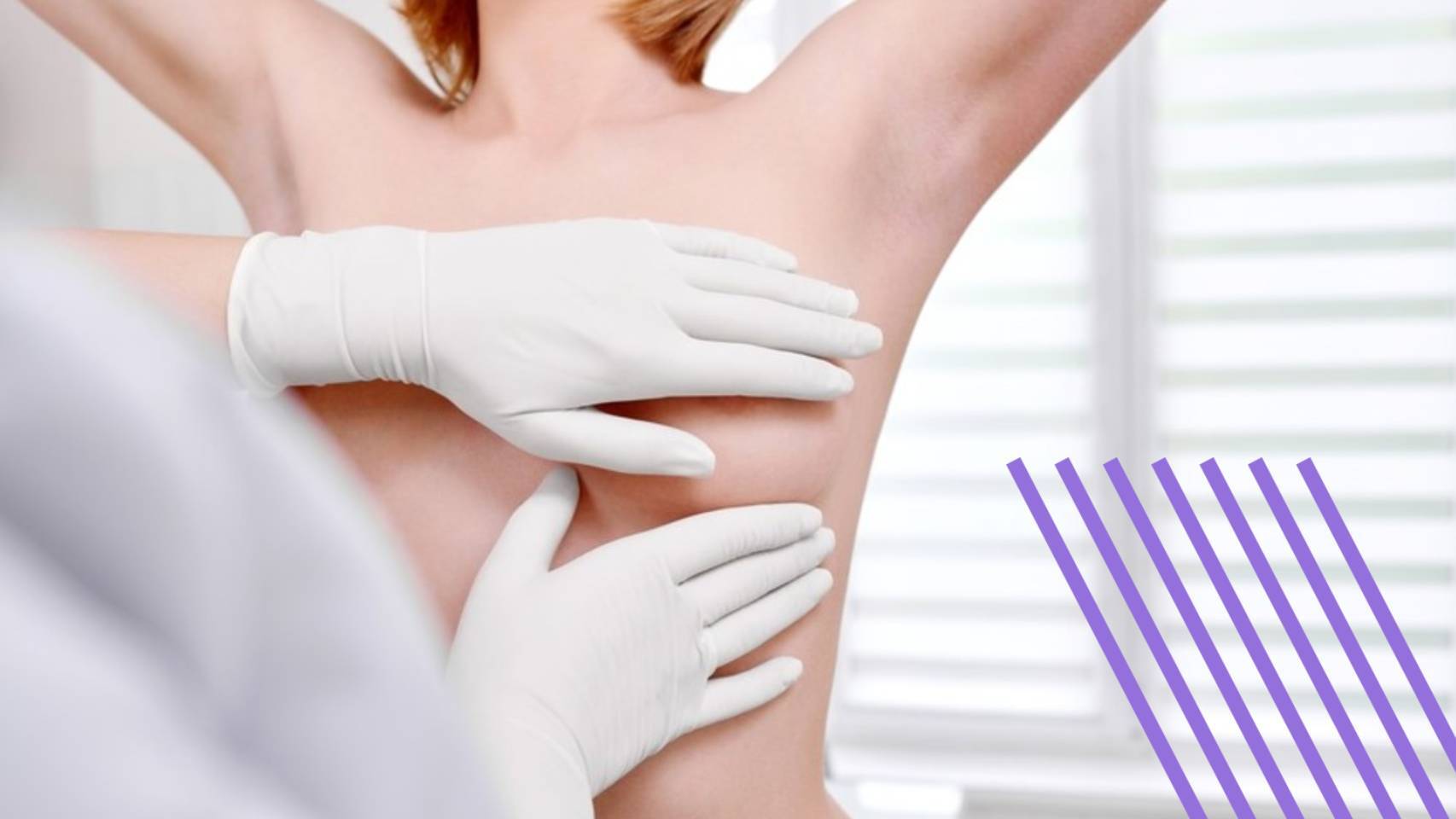 FOTO Pacientes Con Cancer De Mama Metastasico