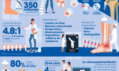 Infografia Osteoartrosis 1