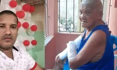 Esperan De Nuevo Jefe PN RD Apresar Joven Agredio A Machetazos Envejeciente