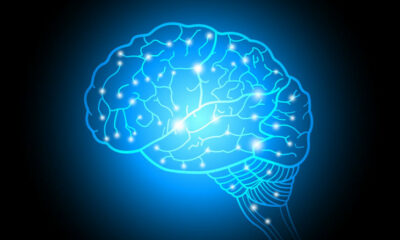 Cerebro