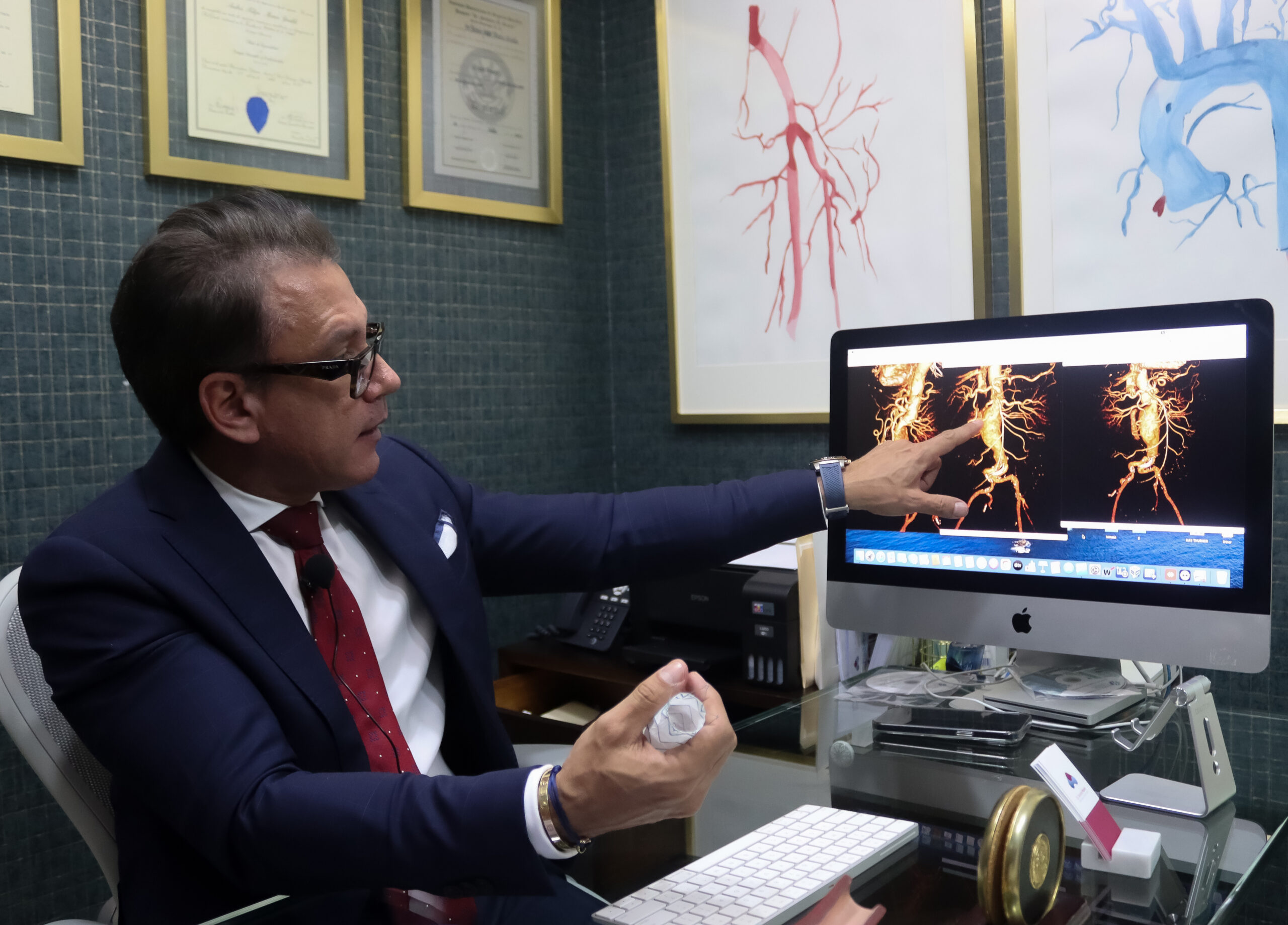 Andres Marin Muestra Aneurisma Scaled