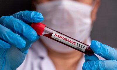 Hantavirus